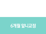 6개월앞니교정