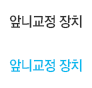 앞니교정 장치