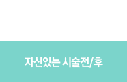 자신있는시술전후