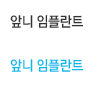 앞니 임플란트