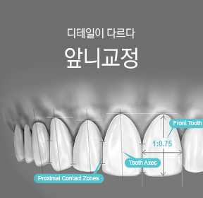 앞니교정